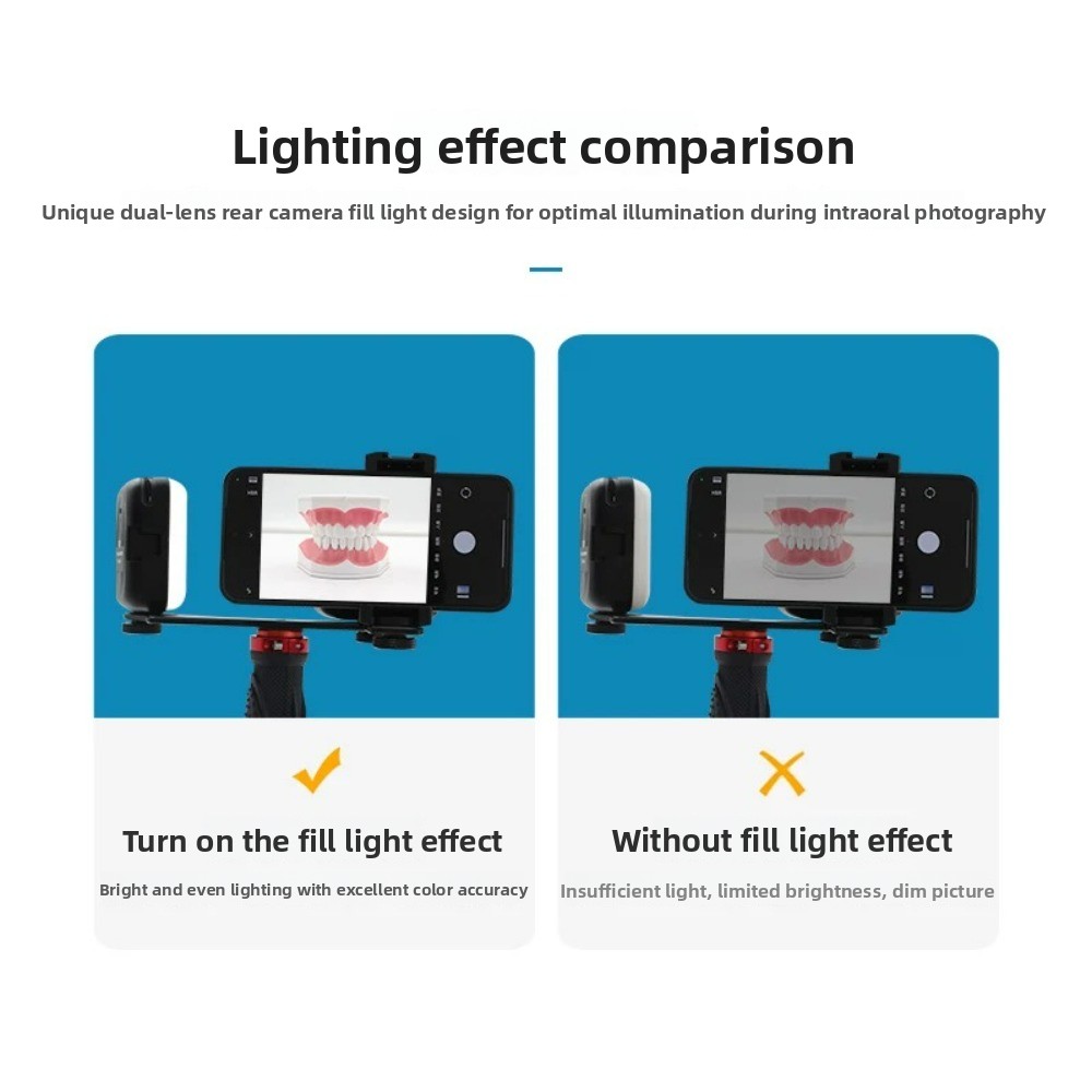 Dental Photography Light, Blue - Photography Lighting Kits ulasan dan harga